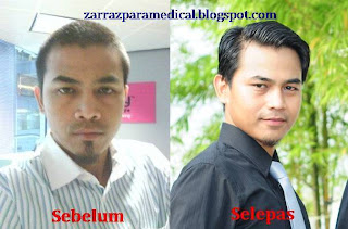 testimoni zarraz paramedical, pengguna produk zarraz paramedical, keberkesanan produk zarraz paramedical, skin care kulit kusam, pencegahan kulit kusam dan tidak bermaya, tips wajah gebu cantik dan berseri, tips wajah kekal muda