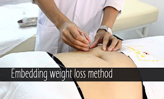 Embedding weight loss Treatment