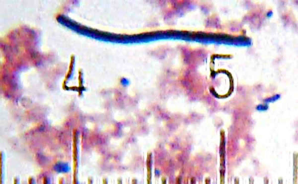 Imagen 359A | Lactobacillus bulgaricus, morfológicamente idéntico a Lactobacillus paracasei | Bsimon2014 / Attribution-ShareAlike 3,0 | Page URL : (https://en.wikipedia.org/wiki/File:Lactobacillus_rhamnosus-LSU_lab_(Dr._Karen_Sullivan).jpg) de Wikimedia Commons