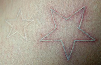  white ink star tattoos