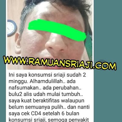 testimoni 1 herbal sriaji