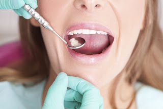 Làm răng implant có nguy hiểm không-3