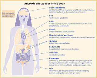 Treat Of Anorexia Nervosa