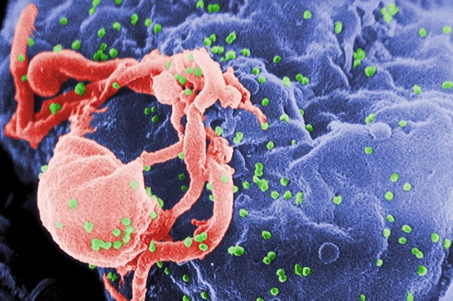 FDA Approves Further Study Of Promising Gene Therapy HIV Treatment