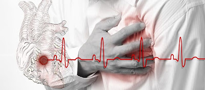 Characteristic chest pain due to heart problems