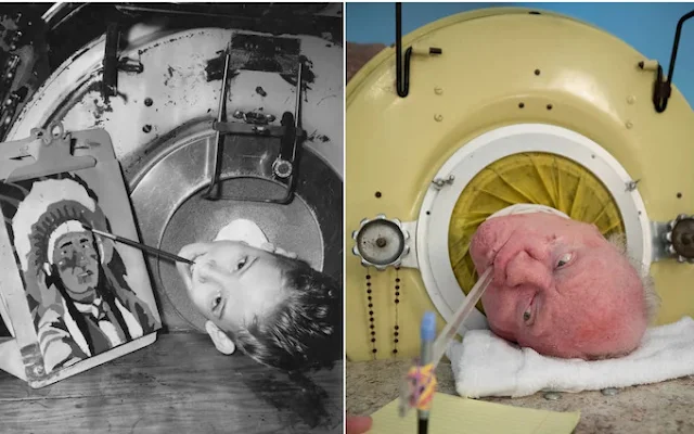 Paul Alexander The Last Man in the Iron Lung