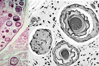 Ichthyophonus Slide 200 x