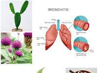 Cara Membuat Obat Herbal dari Prof. Hembing Untuk Bronkhitis