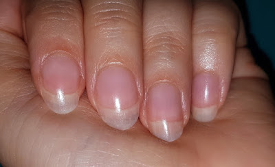 Pink Cloud 3-in-1 Collagen Beauty Drink - Nails After