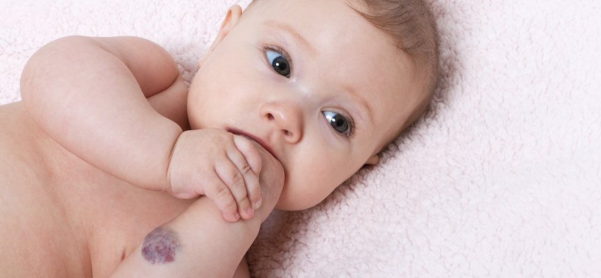 Benarkah Bayi Perlu Untuk Dipijat? Yuk Baca Infonya Berikut Ini Biar Bunda Makin Tahu Apa Saja Manfaatnya