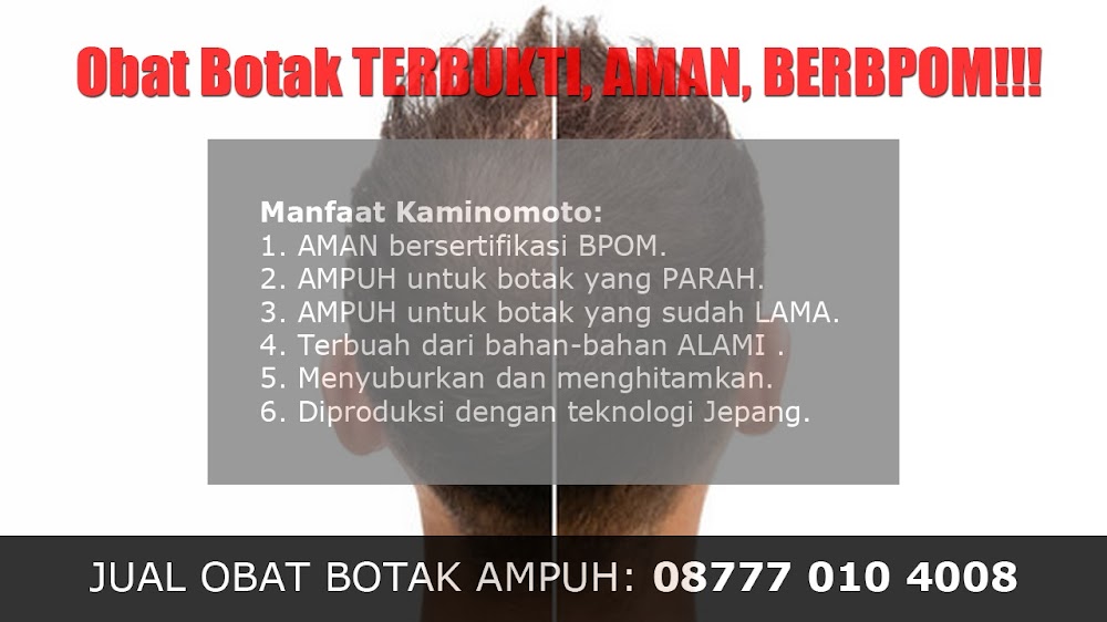 jual OBAT PENUMBUH RAMBUT BOTAK Ploso<br/>