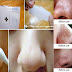 How To Remove Tons Of Blackheads & Whiteheads Instantly!