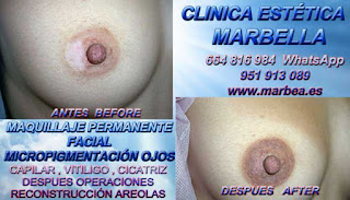 micropigmentación de la areola Mastectomia Tratamiento cicatrices senos