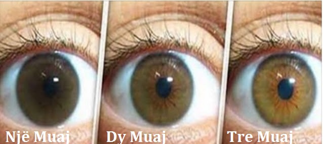 Receta natyrale për pastrimin e Syve dhe zhvillimin e shikimit brenda 3 muajsh