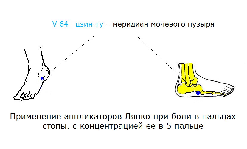 Почему может болеть стопа. Боль в области свода стопы. Болит внешний свод стопы. Болит свод стопы с внешней стороны причины. Болит внешняя сторона стопы.