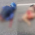 IMAGENS FORTES! CASAL FICA COM OS CORPOS DESPEDAÇADOS APÓS ACIDENTE ENTRE MOTO E CARRO EM RODOVIA. TUDO FILMADO. VEJA VÍDEO