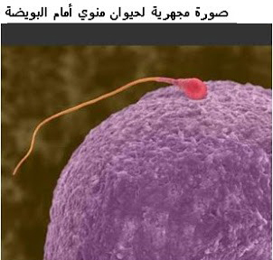 تحليل السائل المنوى | تحليل المنى | Semen Analysis