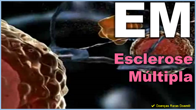 EM - Esclerose Múltipla