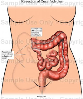 eyewitnessanimations.medicalillustration.com