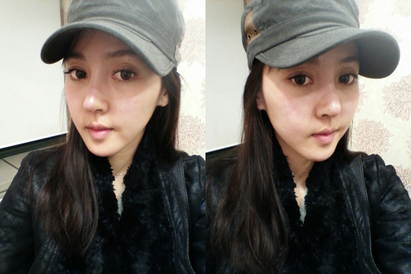 짱이뻐! - Wonjin Nose Surgery To Get Nose Like a Doll
