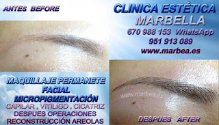 microblading Granada Clínica Estética Maquillaje Permanente Facial,  Micropigmentación Capilar y microblading cejas en Marbella y Granada: Te ofrecemos la alta calidad de servicios con los mejores expertos en micropigmentación capilar y microblading cejas