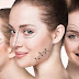 Plastic Surgery