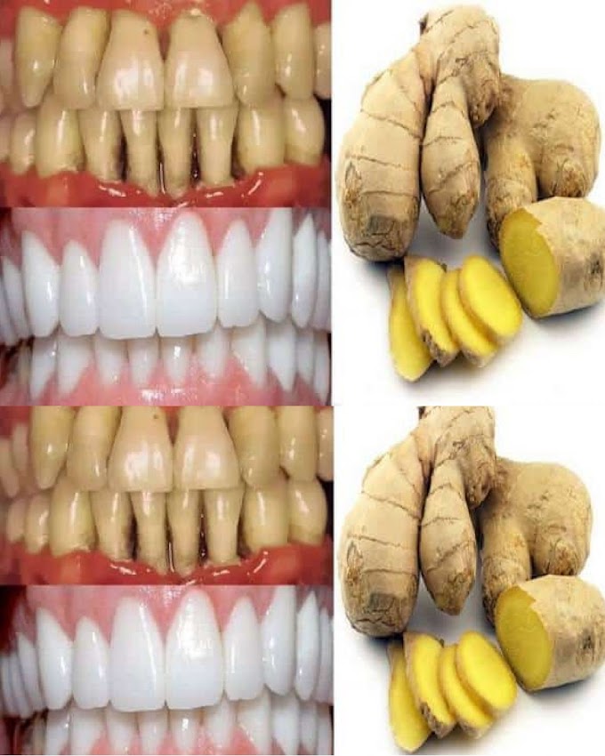This remedy, which contains ginger and salt, may be used to whiten teeth.