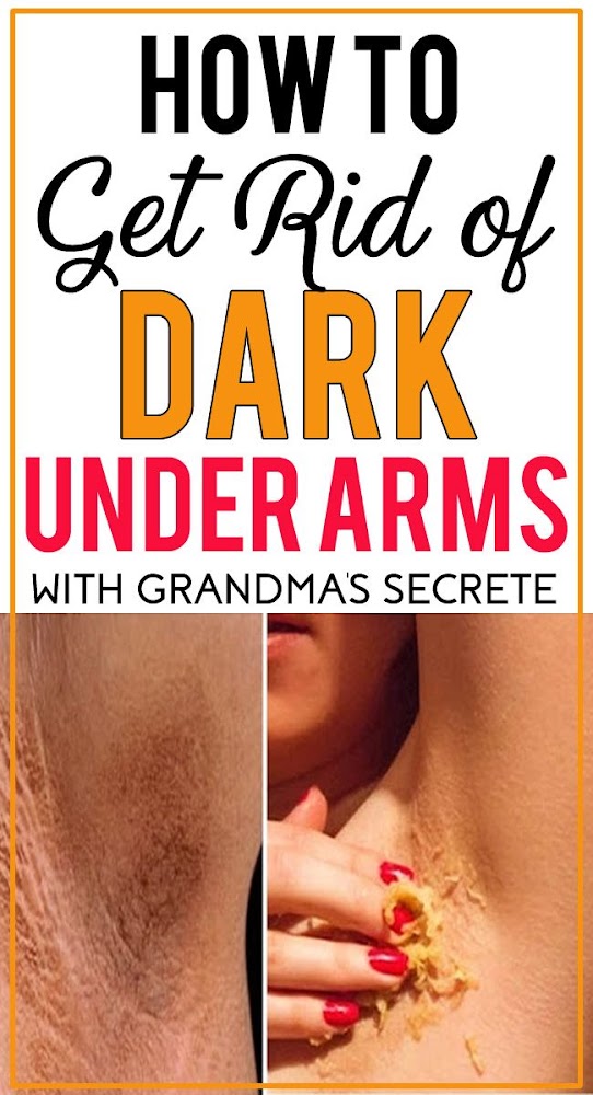 dark armpits and groin during pregnancy