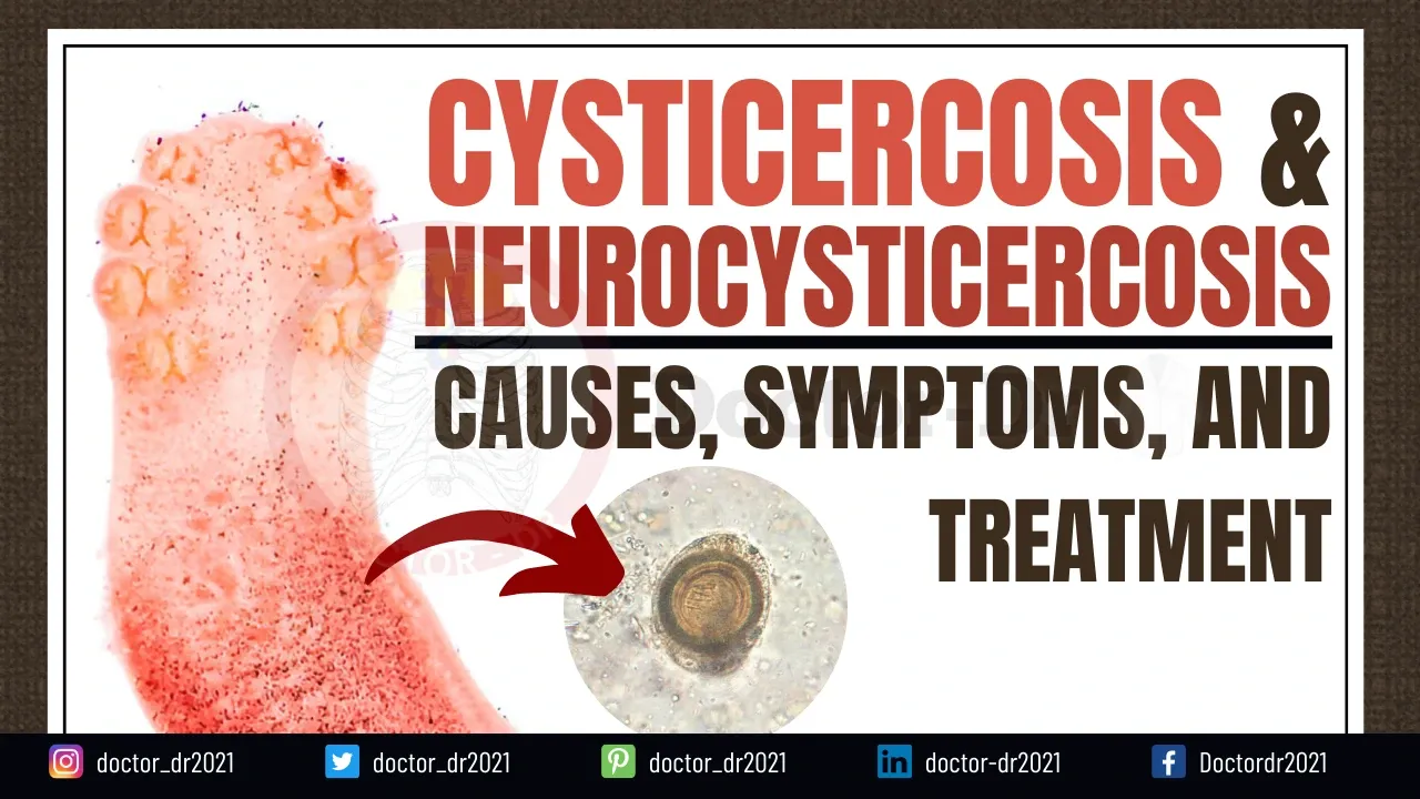 Comprehensive Guide to Cysticercosis and Neurocysticercosis: Causes, Symptoms & Treatment - Parasitology Notes By Microbiologist Doctor_dr2021