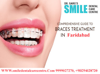 Dental Braces Treatment