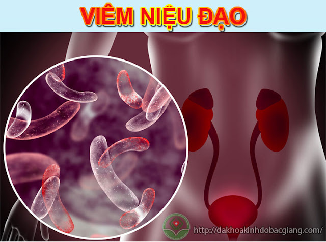 Viêm niệu đạo phải làm sao?