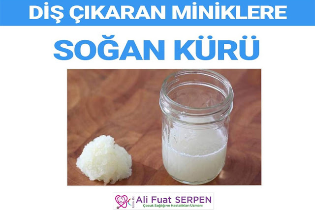 Diş Çıkarma Dönemi İçin Soğan Kürü