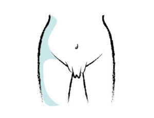 Kruarje në vaginë