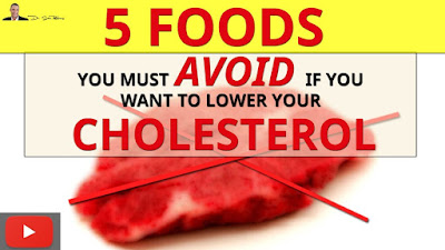 5 Worst High Cholesterol Foods You Must Avoid