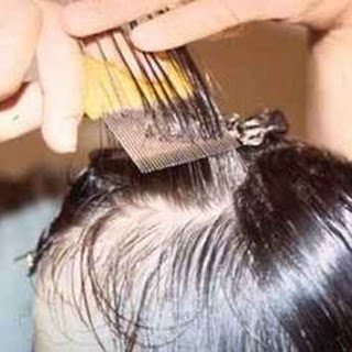 Lice In Hair Removal