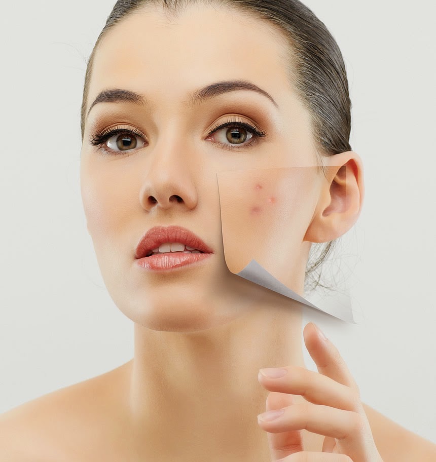 How To Get Rid Of Back Acne How To Get Rid Of Back Acne