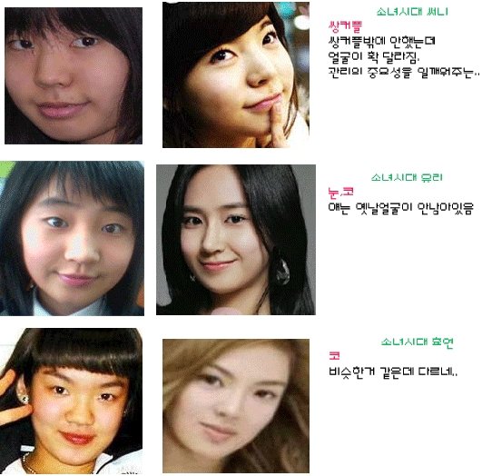 SNSD Girls Generation Sunny before and after