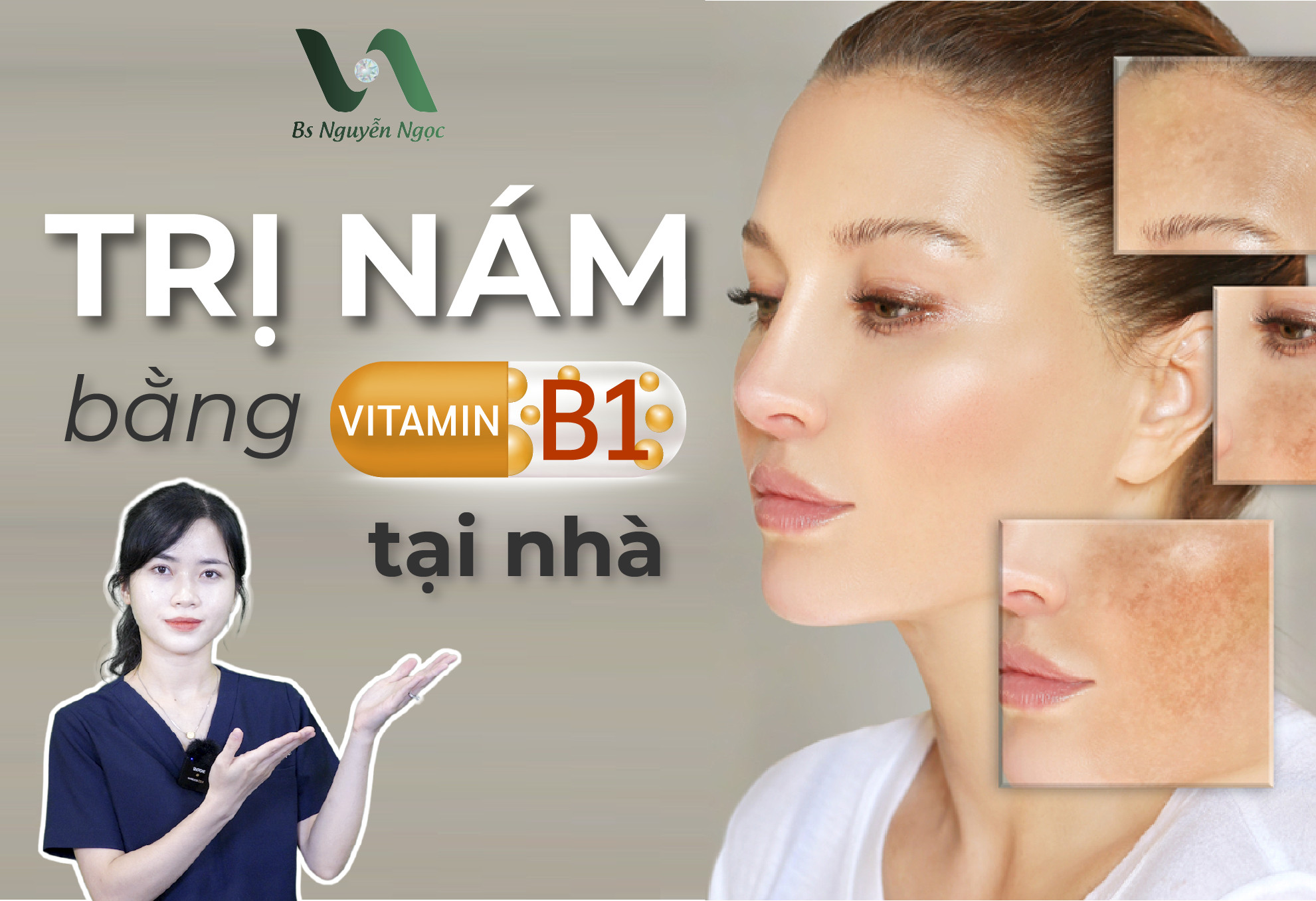 tri-nam-bang-vitamin-b1