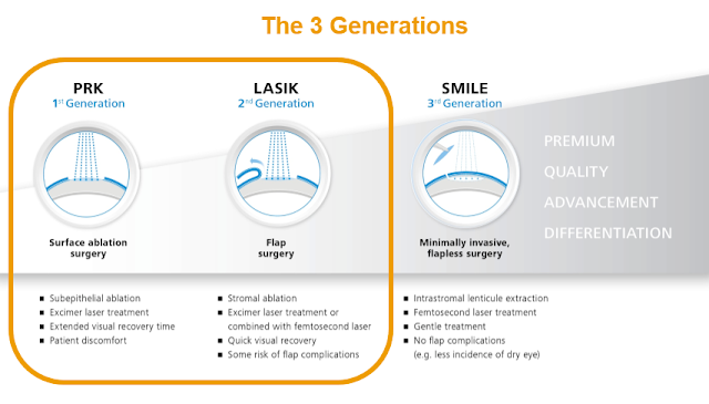 SMILE and lasik comparison image