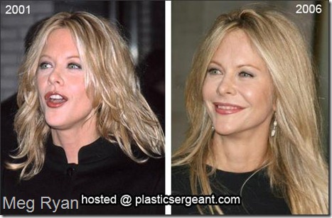 Meg Ryan