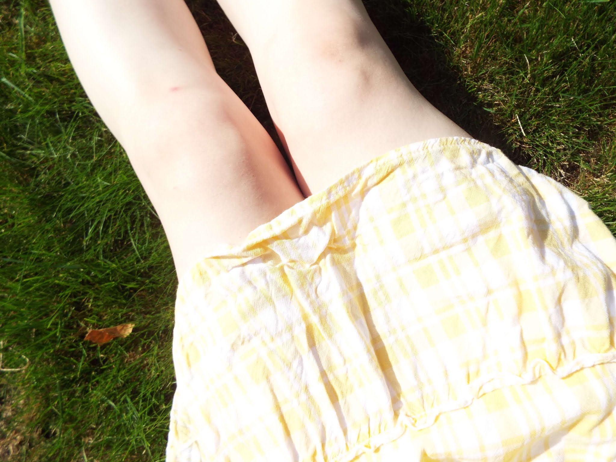 Legs resting, stretched out, on the grass diagonally. My yellow gingham dress rests over the tops of my legs.