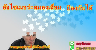 อัลไซเมอร์ ความจำเสื่อม อะไรคือสาเหตุ