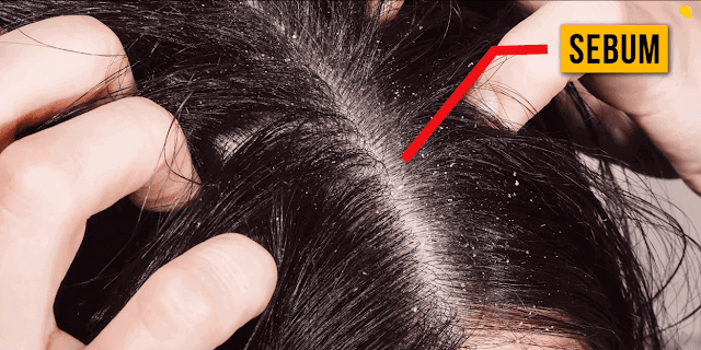 What If You Stopped Washing Your Hair for a Year?