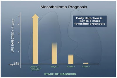 Understanding a Mesothelioma Prognosis - Does Anyone Survive Mesothelioma