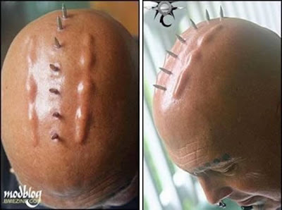 Most Weird Body Implants Seen On lolpicturegallery.blogspot.com