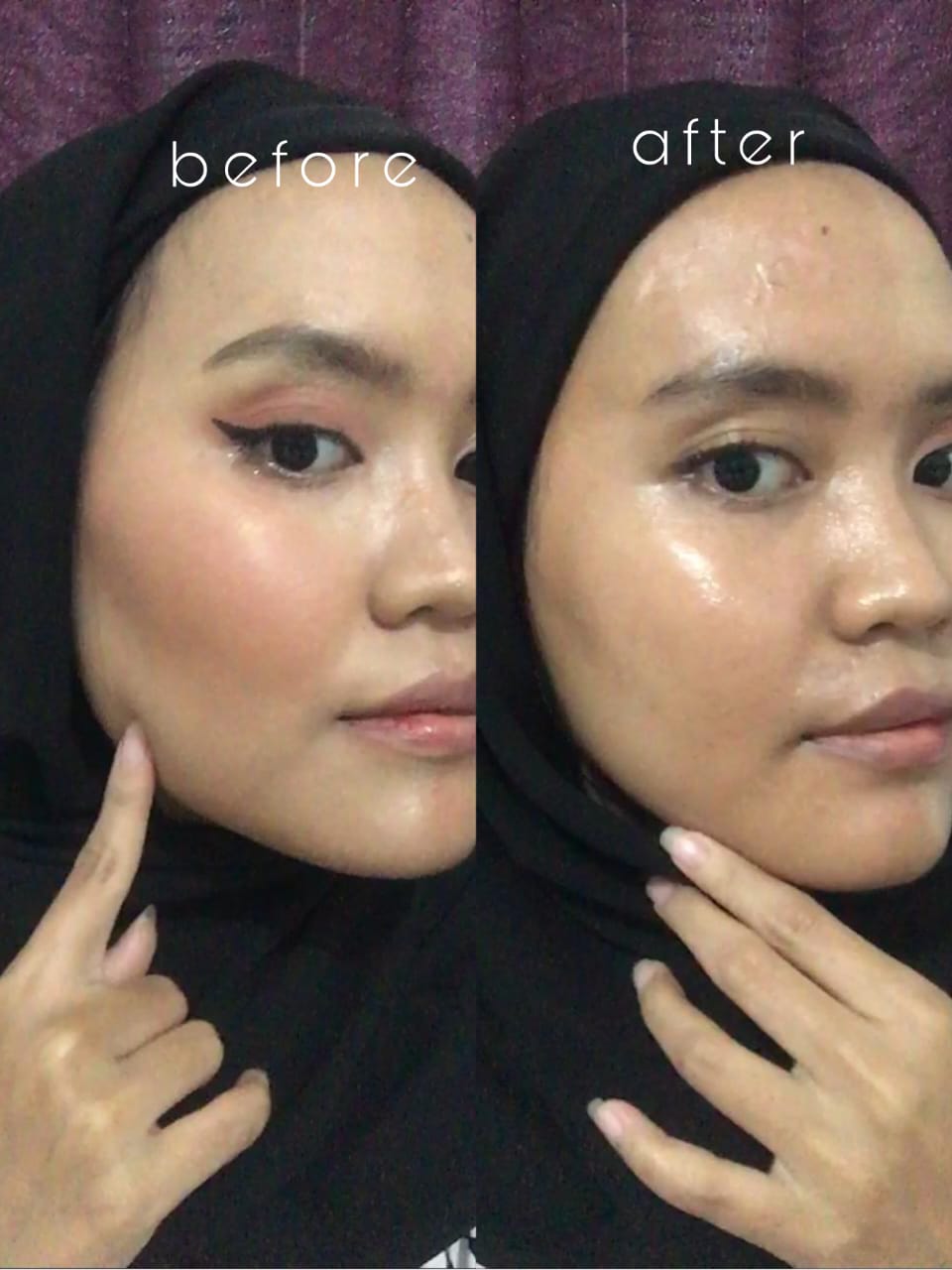 before after andayani rhani