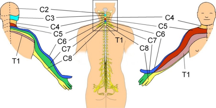 Imagens de hernia de disco cervical c5 c6