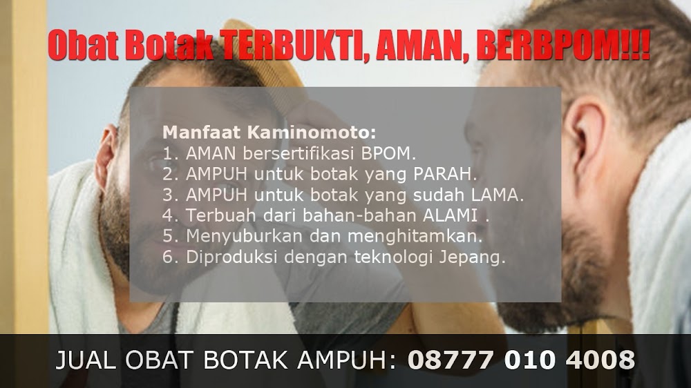 CARA MENUMBUHKAN RAMBUT PADA BEKAS BISUL DI KEPALA<br/>Rengat<br/>