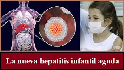 La nueva hepatitis infantil aguda