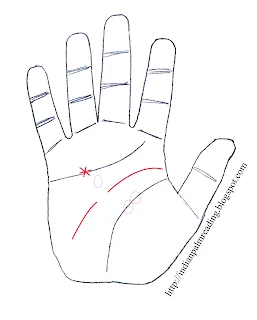 sign of blindness in palmistry